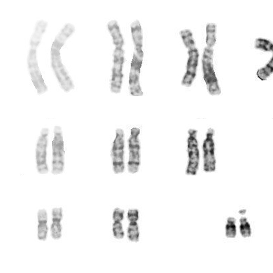 chromosome interphase profiling products of conception test